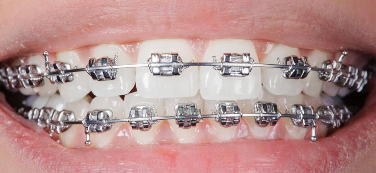 Orthodontics